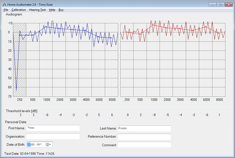 Home Audiometer Hearing Test